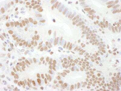 Immunohistochemistry: Rad17 [p Ser645] Antibody [NB100-273]